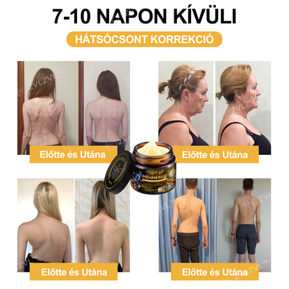 🎁 Már csak 5 doboz maradt! Extra 50% kedvezmény most! Segíts ízületeidnek rugalmasabbá és kényelmesebbé válni a mindennapokban. Ez az ajánlat idén utoljára elérhető!