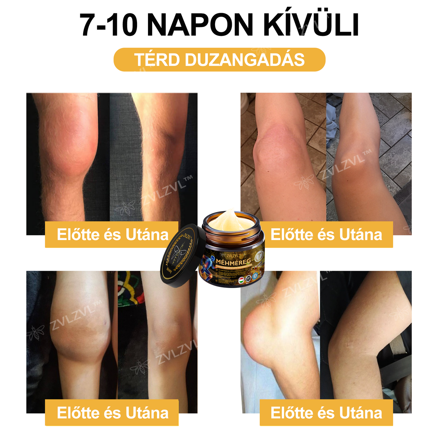 🎁 Már csak 5 doboz maradt! Extra 50% kedvezmény most! Segíts ízületeidnek rugalmasabbá és kényelmesebbé válni a mindennapokban. Ez az ajánlat idén utoljára elérhető!