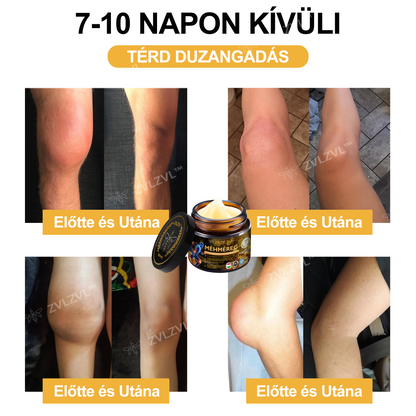 🎁 Már csak 5 doboz maradt! Extra 50% kedvezmény most! Segíts ízületeidnek rugalmasabbá és kényelmesebbé válni a mindennapokban. Ez az ajánlat idén utoljára elérhető!