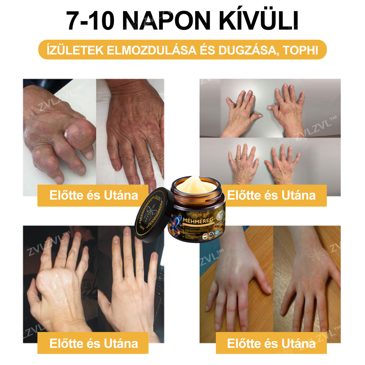 🎁 Már csak 5 doboz maradt! Extra 50% kedvezmény most! Segíts ízületeidnek rugalmasabbá és kényelmesebbé válni a mindennapokban. Ez az ajánlat idén utoljára elérhető!