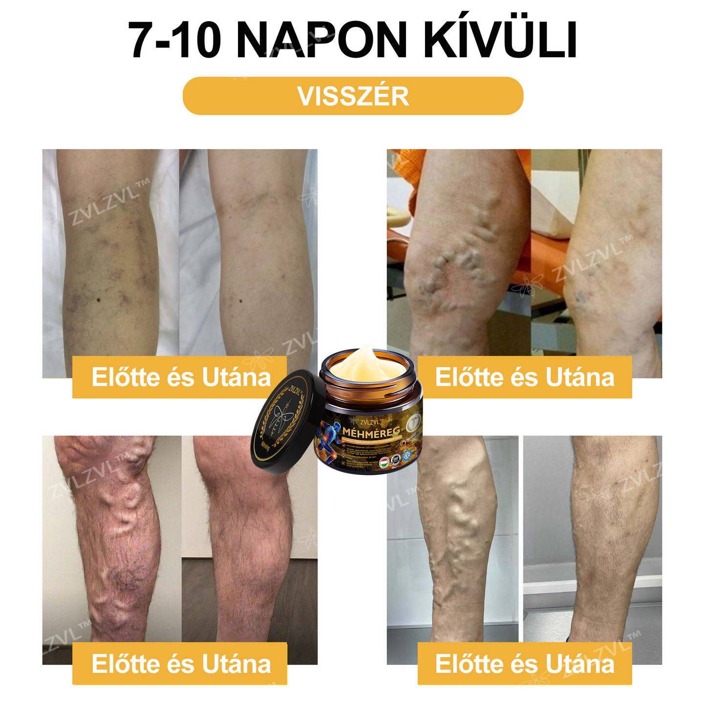 🎁 Már csak 5 doboz maradt! Extra 50% kedvezmény most! Segíts ízületeidnek rugalmasabbá és kényelmesebbé válni a mindennapokban. Ez az ajánlat idén utoljára elérhető!