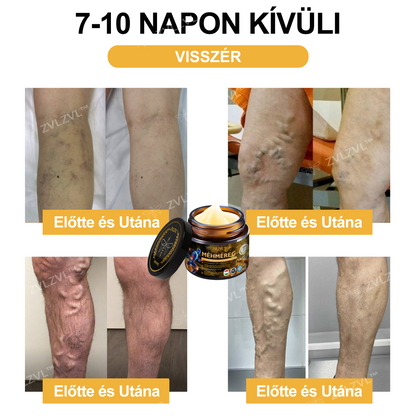 🎁 Már csak 5 doboz maradt! Extra 50% kedvezmény most! Segíts ízületeidnek rugalmasabbá és kényelmesebbé válni a mindennapokban. Ez az ajánlat idén utoljára elérhető!